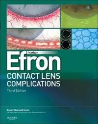 Contact Lens Complications Expert Consult - Online and Print [Elektronisk resurs]