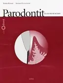 Parodontit : en introduktion