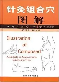 针灸组合穴图解Volym 2 av Chinese-English edition
