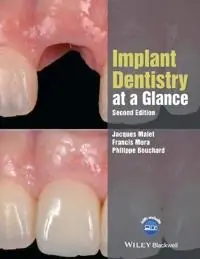 Implant Dentistry at a Glance [Elektronisk resurs]