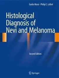 Histological Diagnosis of Nevi and Melanoma [Elektronisk resurs]