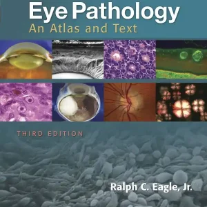 Eye Pathology - Begagnad bok
