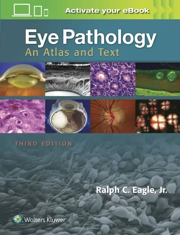 Eye Pathology - Begagnad bok