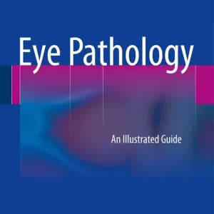 Eye Pathology